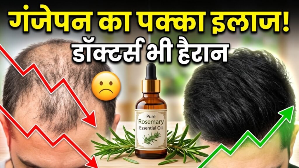 Rosemary Oil, Hair Growth Tips, Hair Fall Control, DHT Blocker, Sesa Rosemary Oil, गंजेपन का इलाज, बाल झड़ने के उपाय, Hair Care Routine